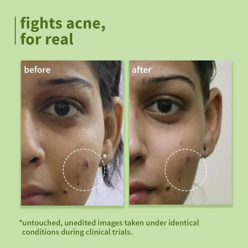 51MHJn4TGVL._SL1001_